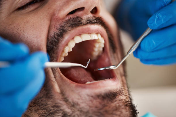Best Teeth Whitening  in Marion, WI